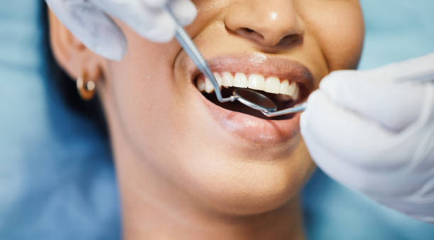 Best Emergency Tooth Extraction in Lake Geneva, WI